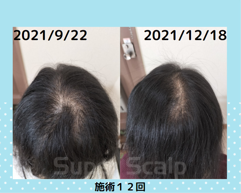 周りからはこんな風に見えてるんですよ👀✨