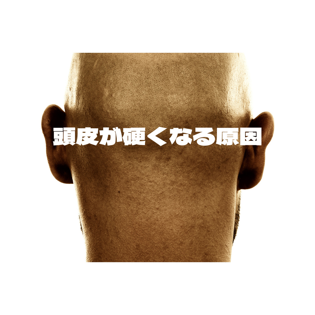 なぜ？頭皮が硬いと薄毛の原因に…？