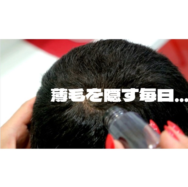 【薄毛】をヘアファンデで隠す毎日…