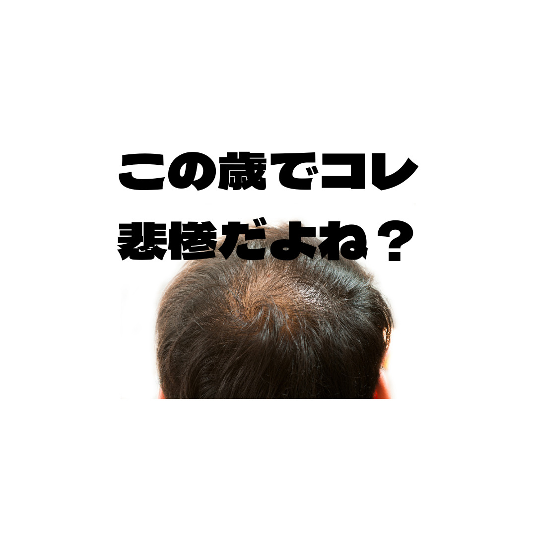 【薄毛治療】この歳でコレ、悲惨だよね？